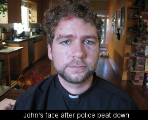 John's face after police beat down