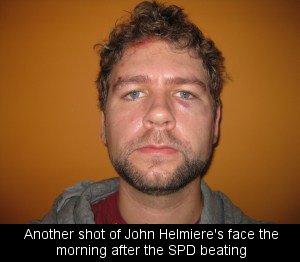 Another shot of John Helmiere's face the morning after the SPD beating